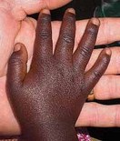 beverly hills chiropractic